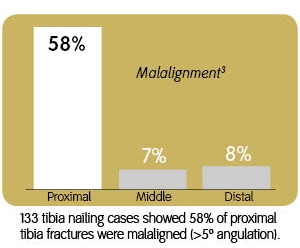 malalignment graph